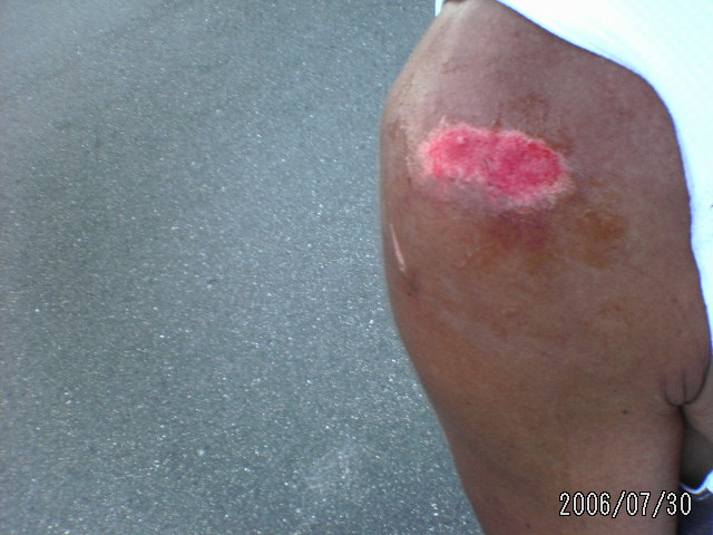 ���̉摜�̒��쌠��
Hiroshima Inline Hockey League(HIHL)�ɂ���܂��B�摜�f�[�^�̖��f�]�p�͌ł����f��\���グ�܂��B