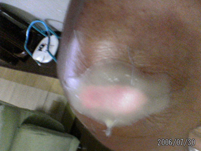 ���̉摜�̒��쌠��
Hiroshima Inline Hockey League(HIHL)�ɂ���܂��B�摜�f�[�^�̖��f�]�p�͌ł����f��\���グ�܂��B