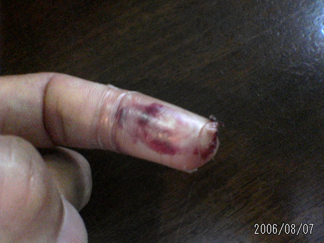 ���̉摜�̒��쌠��
Hiroshima Inline Hockey League(HIHL)�ɂ���܂��B�摜�f�[�^�̖��f�]�p�͌ł����f��\���グ�܂��B