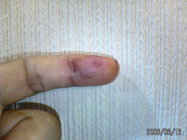 ���̉摜�̒��쌠��
Hiroshima Inline Hockey League(HIHL)�ɂ���܂��B�摜�f�[�^�̖��f�]�p�͌ł����f��\���グ�܂��B