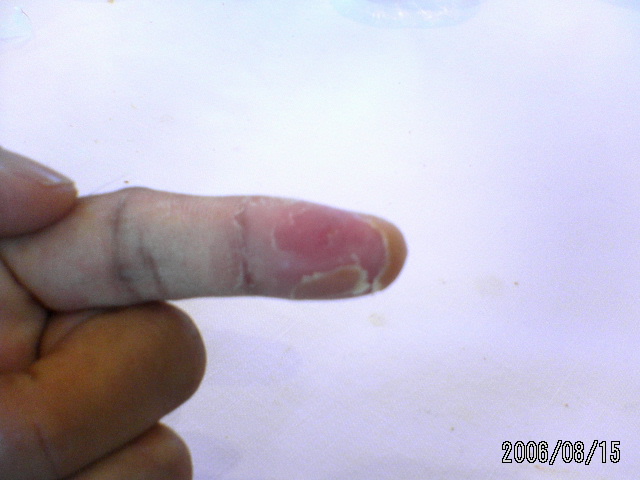 ���̉摜�̒��쌠��
Hiroshima Inline Hockey League(HIHL)�ɂ���܂��B�摜�f�[�^�̖��f�]�p�͌ł����f��\���グ�܂��B