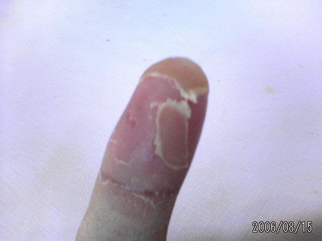 ���̉摜�̒��쌠��
Hiroshima Inline Hockey League(HIHL)�ɂ���܂��B�摜�f�[�^�̖��f�]�p�͌ł����f��\���グ�܂��B