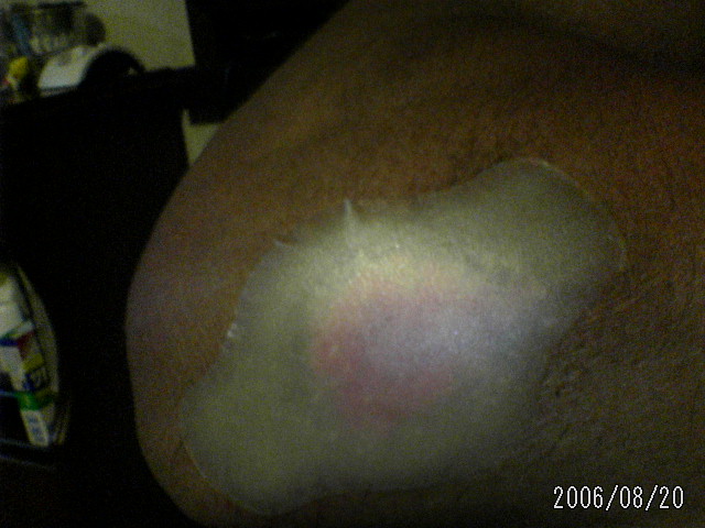 ���̉摜�̒��쌠��
Hiroshima Inline Hockey League(HIHL)�ɂ���܂��B�摜�f�[�^�̖��f�]�p�͌ł����f��\���グ�܂��B