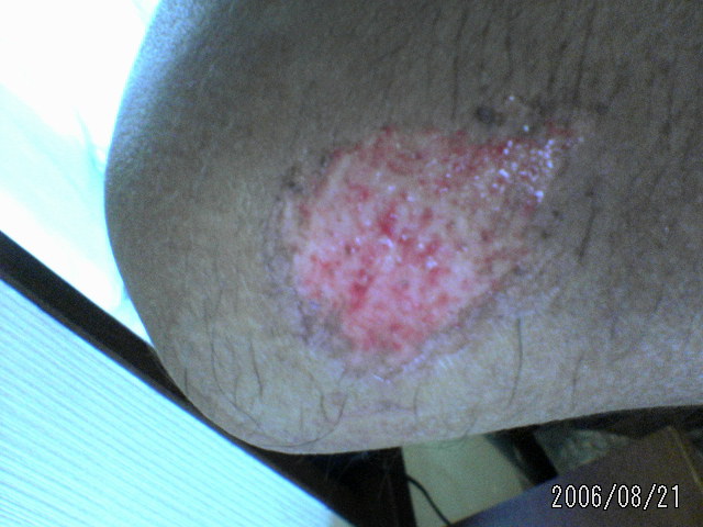 ���̉摜�̒��쌠��
Hiroshima Inline Hockey League(HIHL)�ɂ���܂��B�摜�f�[�^�̖��f�]�p�͌ł����f��\���グ�܂��B