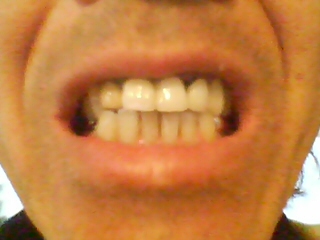 ���̉摜�̒��쌠��
Hiroshima Inline Hockey League(HIHL)�ɂ���܂��B�摜�f�[�^�̖��f�]�p�͌ł����f��\���グ�܂��B