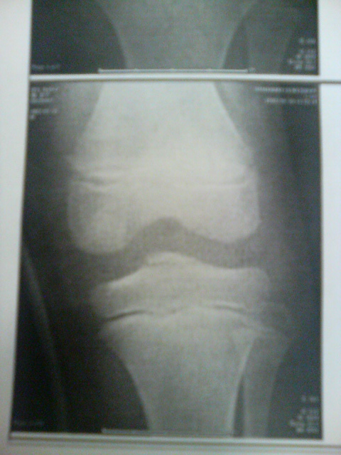 ���̉摜�̒��쌠��
Hiroshima Inline Hockey League(HIHL)�ɂ���܂��B�摜�f�[�^�̖��f�]�p�͌ł����f��\���グ�܂��B