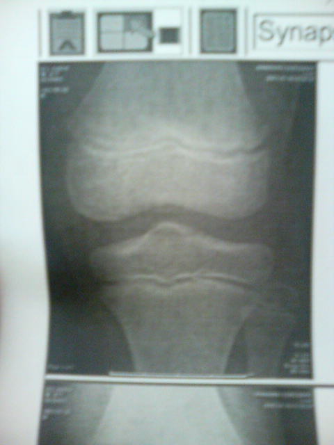 ���̉摜�̒��쌠��
Hiroshima Inline Hockey League(HIHL)�ɂ���܂��B�摜�f�[�^�̖��f�]�p�͌ł����f��\���グ�܂��B