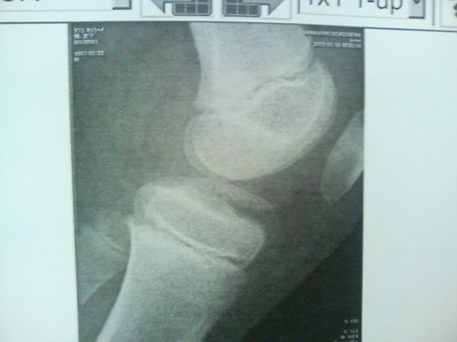 ���̉摜�̒��쌠��
Hiroshima Inline Hockey League(HIHL)�ɂ���܂��B�摜�f�[�^�̖��f�]�p�͌ł����f��\���グ�܂��B