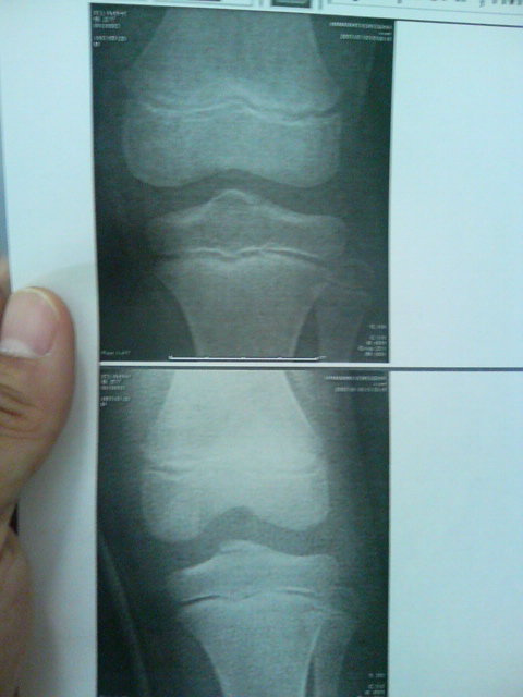 ���̉摜�̒��쌠��
Hiroshima Inline Hockey League(HIHL)�ɂ���܂��B�摜�f�[�^�̖��f�]�p�͌ł����f��\���グ�܂��B