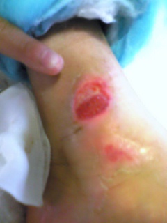 ���̉摜�̒��쌠��
Hiroshima Inline Hockey League(HIHL)�ɂ���܂��B�摜�f�[�^�̖��f�]�p�͌ł����f��\���グ�܂��B