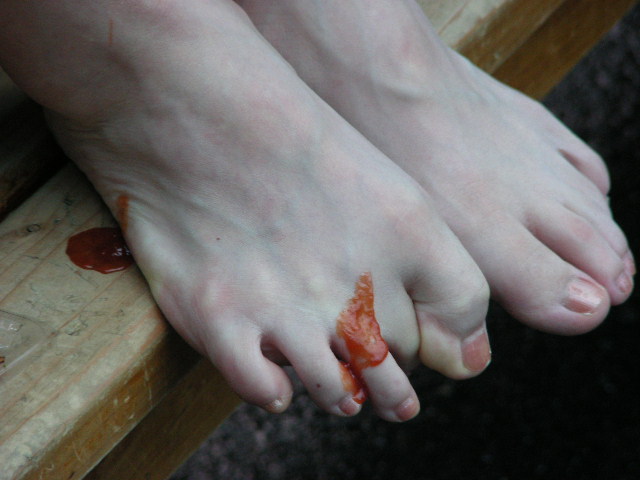 ���̉摜�̒��쌠��
Hiroshima Inline Hockey League(HIHL)�ɂ���܂��B�摜�f�[�^�̖��f�]�p�͌ł����f��\���グ�܂��B