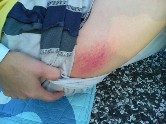 ���̉摜�̒��쌠��
Hiroshima Inline Hockey League(HIHL)�ɂ���܂��B�摜�f�[�^�̖��f�]�p�͌ł����f��\���グ�܂��B